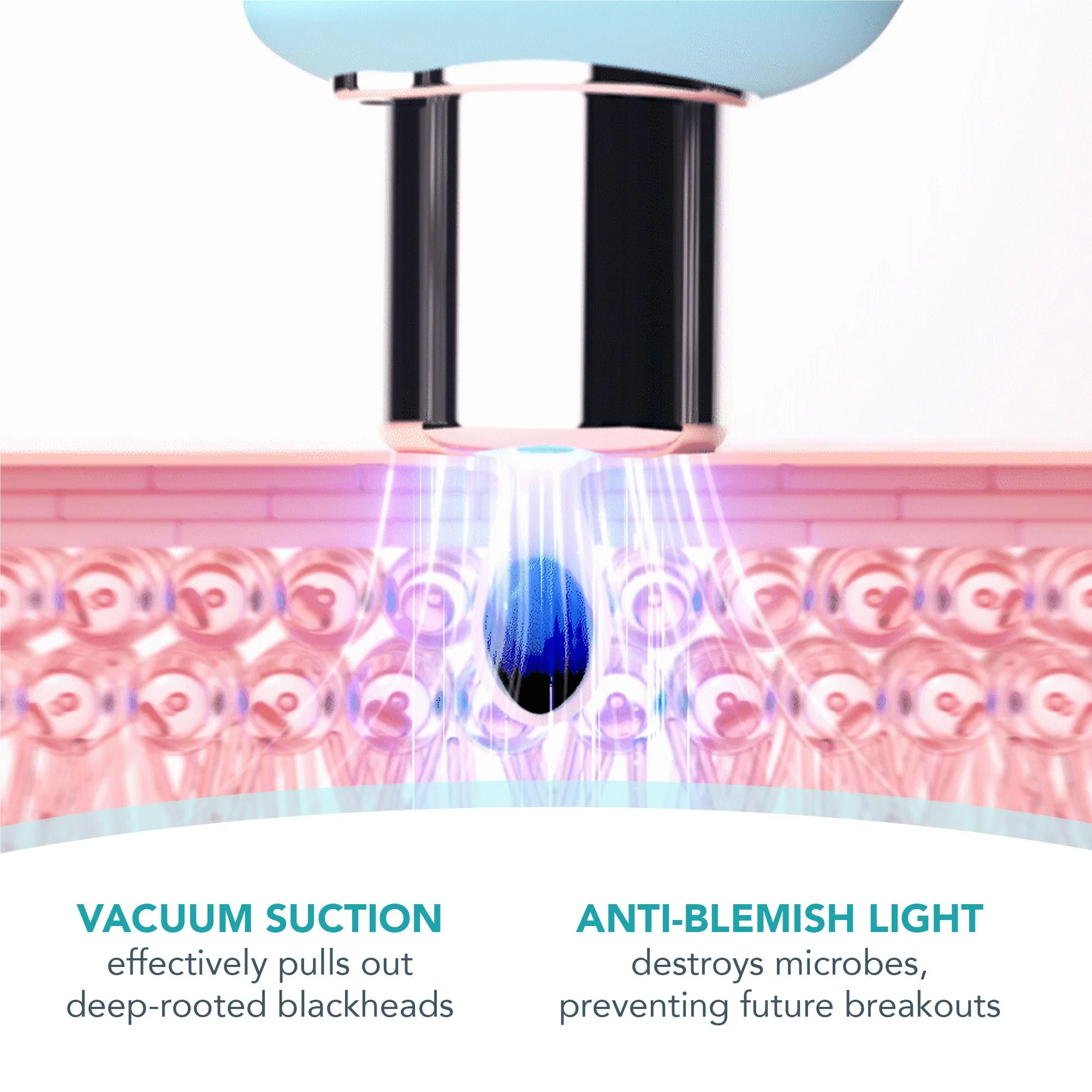 Foreo Kiwi Blackhead Pore Vacuum (Mint) - Image 5